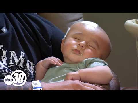 6-month-old released from Valley Children's after 3 months in rehab from suspected abuse