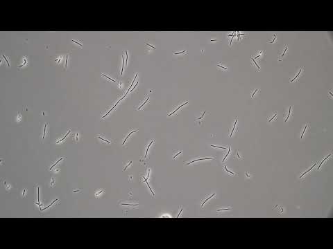 Видео: Транскрипционный ответ Clostridium Beijerinckii NRRL B-598 на бутанольный шок