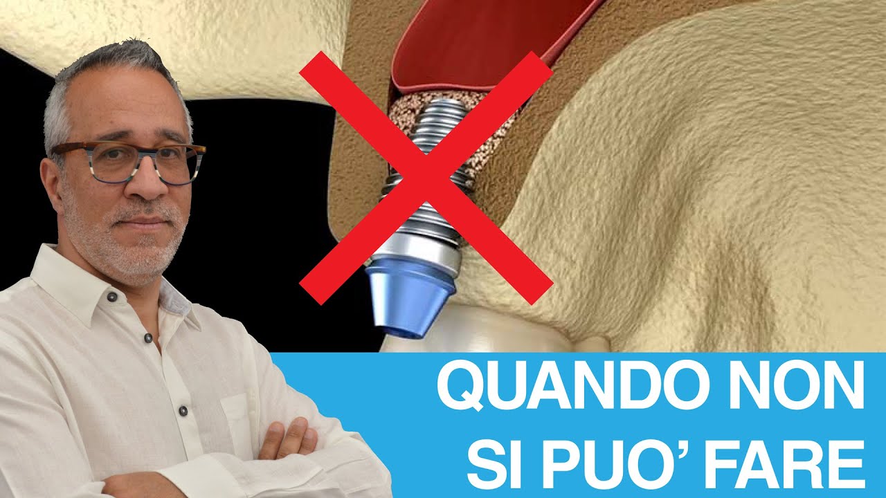 Rialzo di seno mascellare: quando non si può fare?
