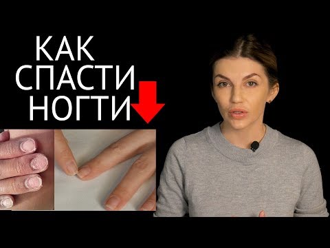 Как восстановить ногти после наращивания в домашних условиях быстро