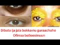 Dibata Ija Jala Bakka Nu Gurraachahe Ofirraa Balleesinun Fuula Hundaafis Ni Taha Dibata Ija Jala Bakka Nu Gurraachahe Ofirraa Balleesinun Fuula Hundaafis Ni Taha