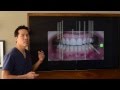 Cosmetic Dentistry - Designing a Perfect Smile