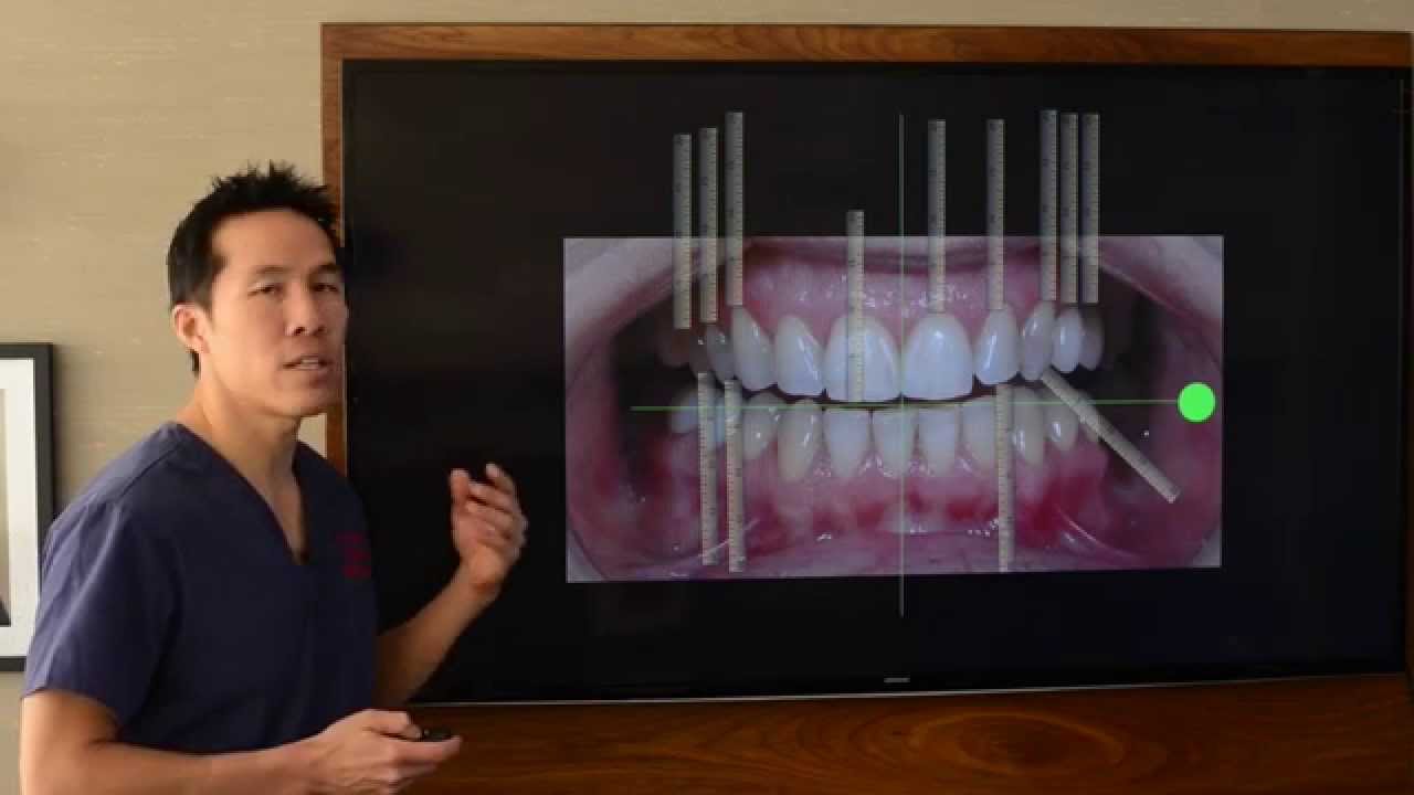 Cosmetic Dentistry - Designing A Perfect Smile