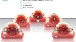Ортодонтия Mondefitlamos