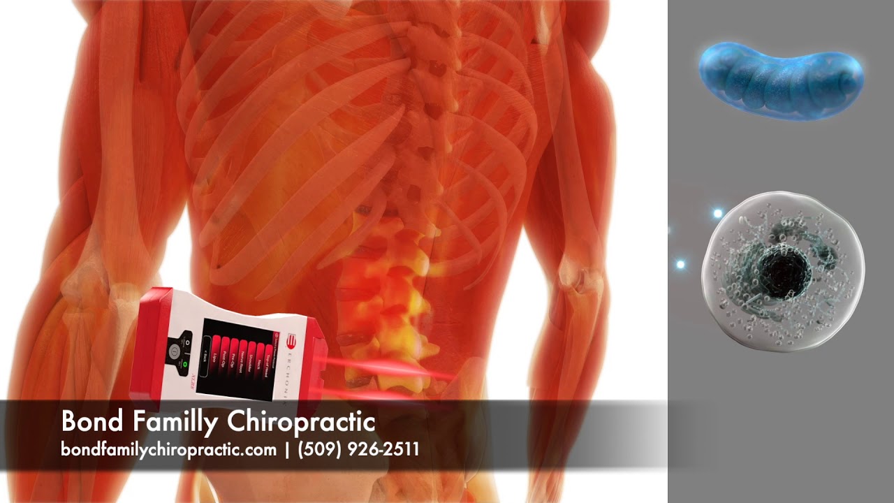 LLLT Patient Education: Low Level Laser Therapy for Low Back Pain (Quick Version)