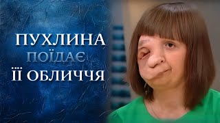 Девушка с половиной лица (полный выпуск) | Говорить Україна