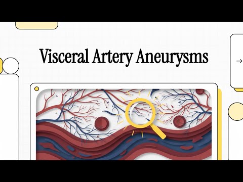 087 Visceral Artery Aneurysms