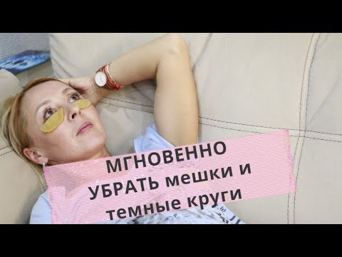 Как мгновенно избавиться от темных кругов и мешков под глазами