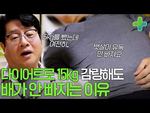 다이어트로 15kg 감량해도 뱃살이 빠지지 않는 이유?