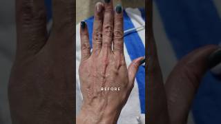 Hands Fascia Blaster Review - Before and After