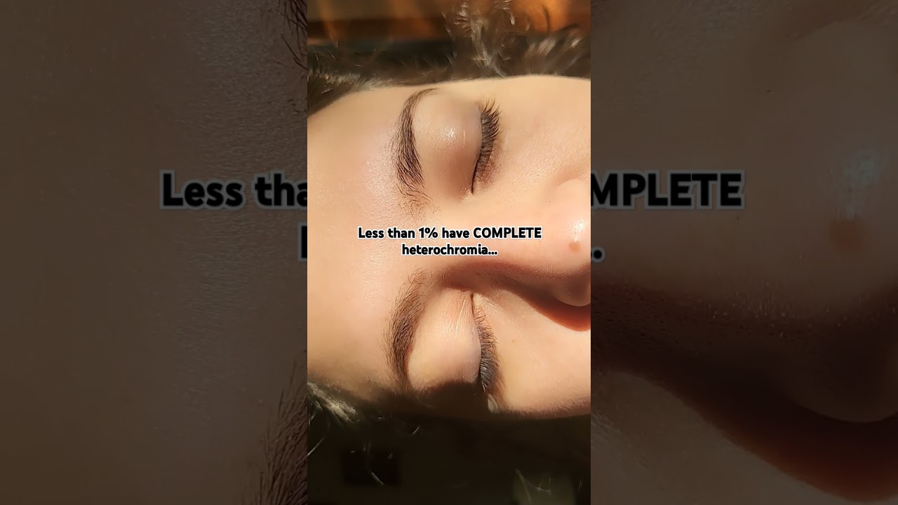 Heterochromia for the win #eyes#green#brown