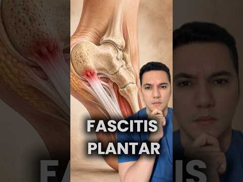 Fascitis plantar podría ser la causa de tu dolor plantar. #dermatologia #dermatologo #medicina