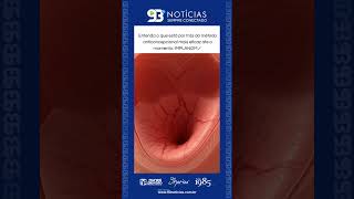 💉🧬 IMPLANON: COMO FUNCIONA O “ANTICONCEPCIONAL DO BRAÇO”?