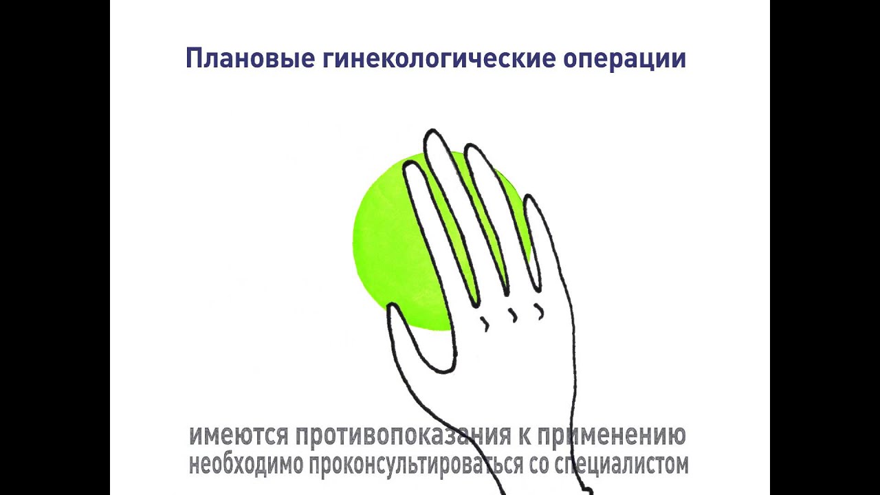 Центр инновационной хирургии Водников - YouTube