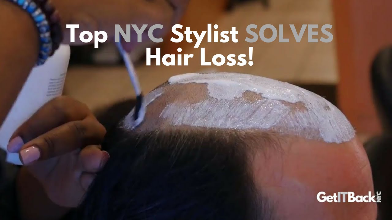 Hair and Scalp Disorders Treatment  NYC  ColumbiaDoctors  New York