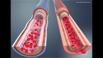 Arteries of the Upper Extremities for Vascular Access