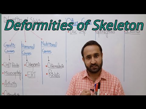 Ch 16 Lec 12 Deformities of Skeleton, Class 12 Biology