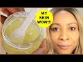 MY SECRET ANTI - AGING VITAMIN C GEL THAT I USE TO LOOK 20 YEARS YOUNGER, WRINKLES + BOOST COLLAGEN