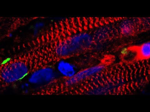 Scientists Figure Out How to Make Muscles from Scratch