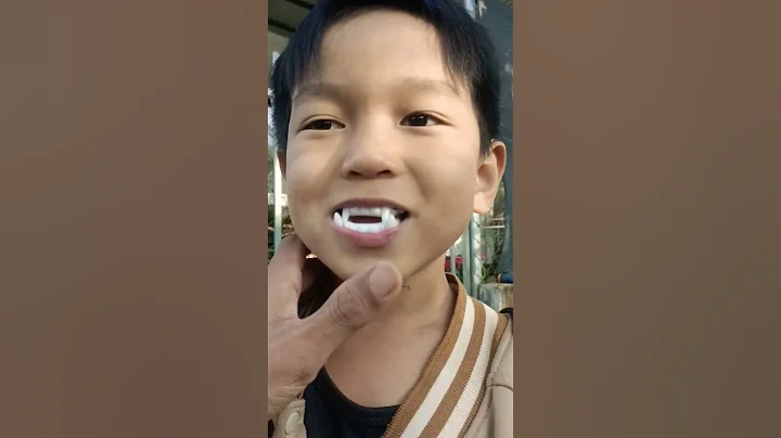 cậu bé có răng lạ như ma cà rồng #shorts
