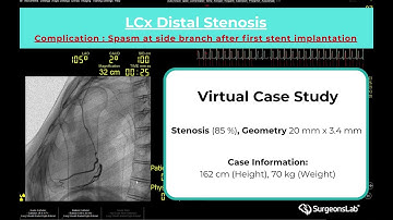 Realistic LCx PCI Simulation — Bifurcation Stenosis & Side Branch Spasm - CathTrain VR | Surgeonslab