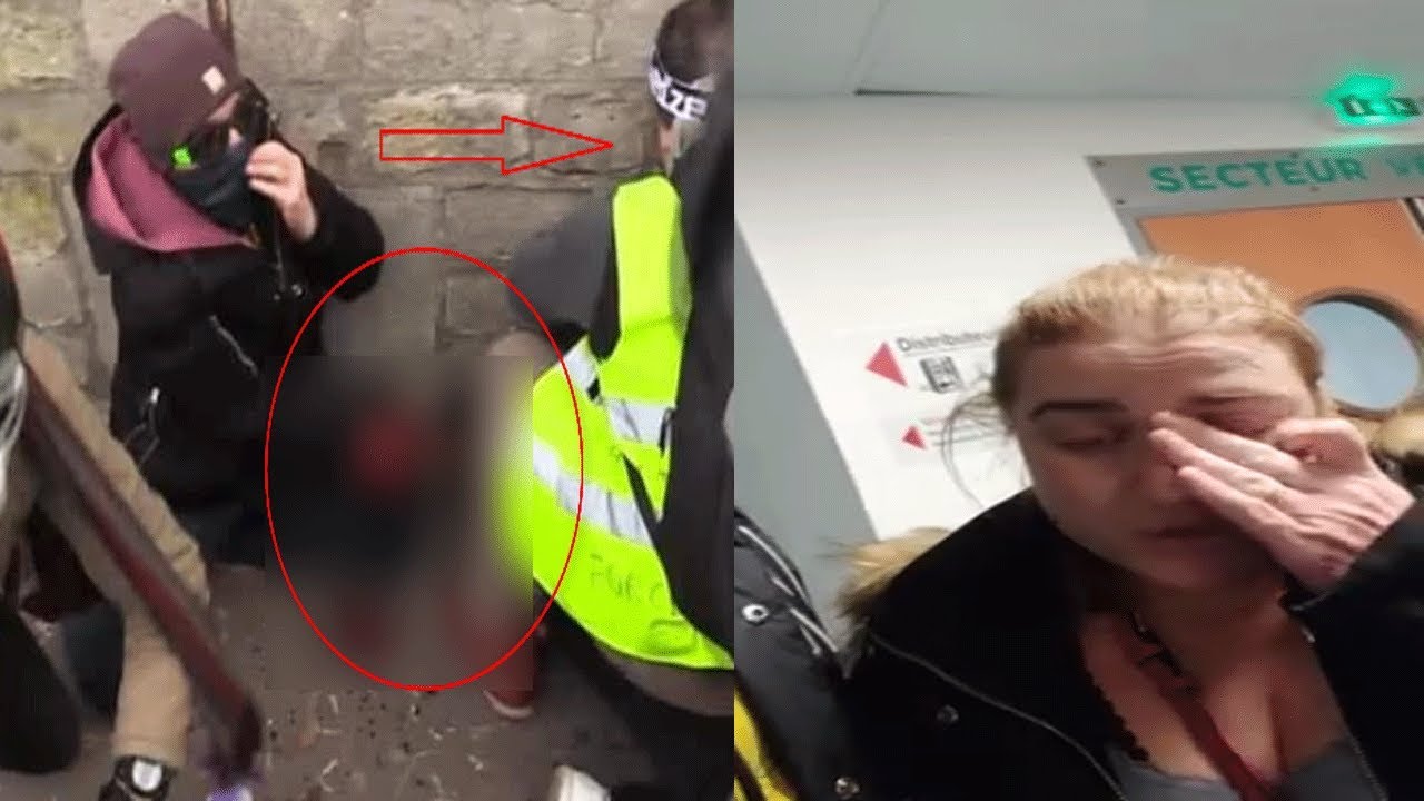 Réouverture Du Dossier Dun Gilet Jaune Qui Avait Eu Sa Main