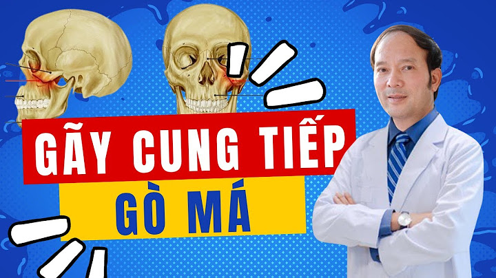 Cung tiếp gò má là gì năm 2024