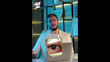 ايه هي أسباب أحمرار العين 