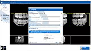 Training: Apteryx XrayVision DCV: Exporting Images