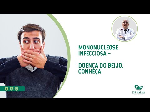 Mononucleose - Doença do Beijo | Dr. Salim CRM 43.163