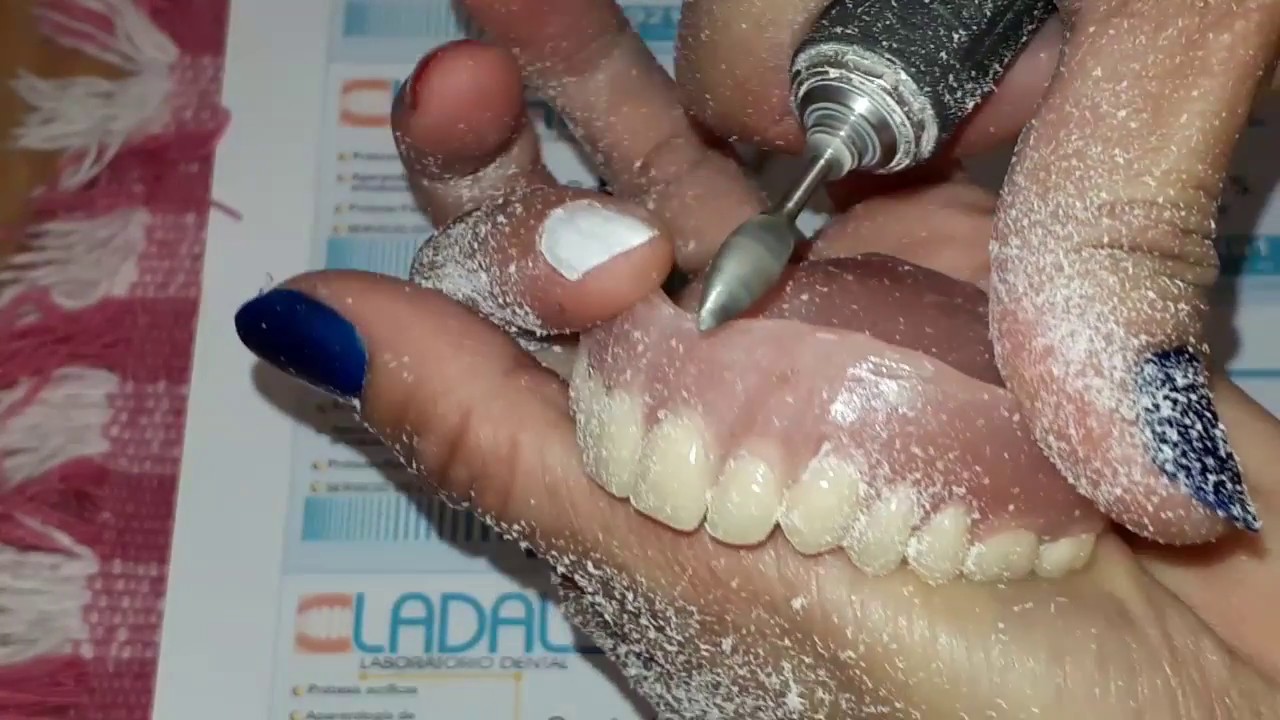 FESTONEADO DENTAL CON MICROMOTOR