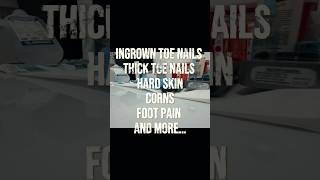 UK-Trained Podiatrist in Jamaica! 🩺 (Kingston, Mandeville & May Pen) #jamaica #feet #podiatry