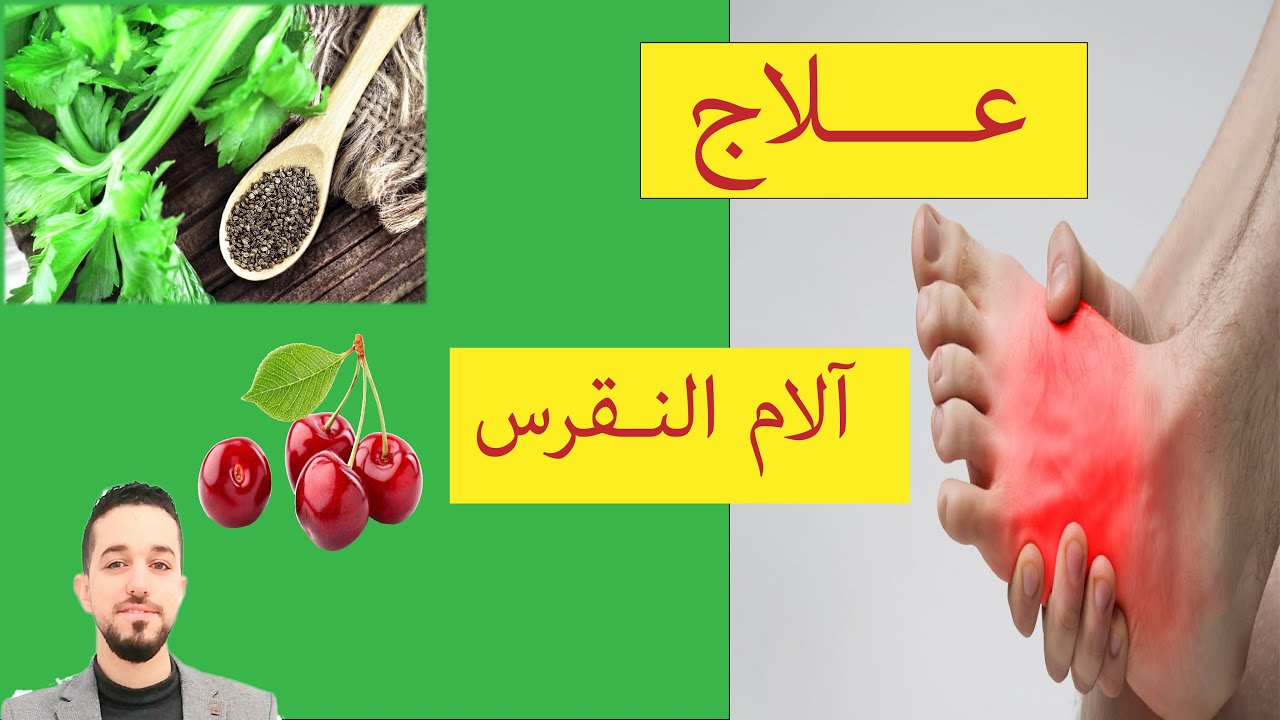 علاج النقرس وأسبابه وأعراضه | ماذا يأكل المصاب بالنقرس | النقرس والسكر