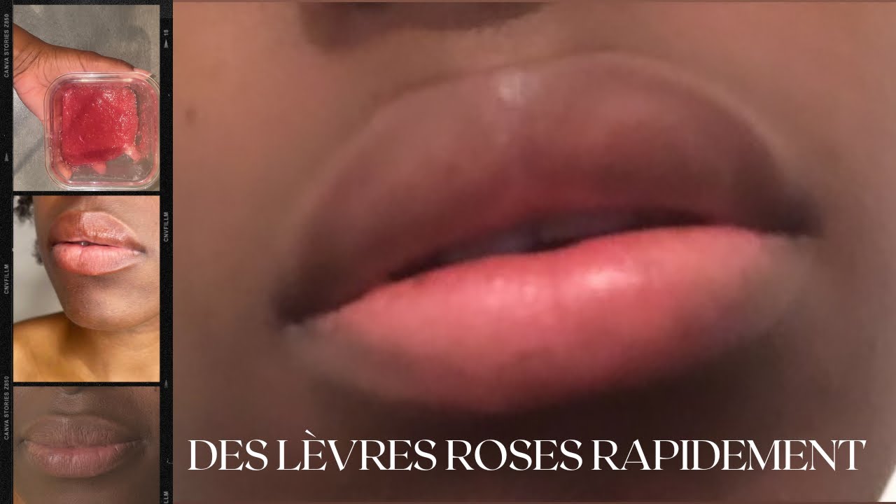COMMENT AVOIR LES LÈVRES ROSES RAPIDEMENT | lèvres foncées - YouTube