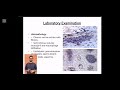 Orchitis and Epididymitis in  Koalas infected with Chlamydia