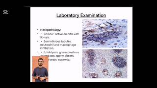 Orchitis and Epididymitis in  Koalas infected with Chlamydia