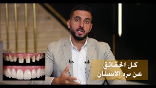 لازم نبرد الاسنان ، حضرتك مدرستش تركيبات ثابته ولا ايه ؟