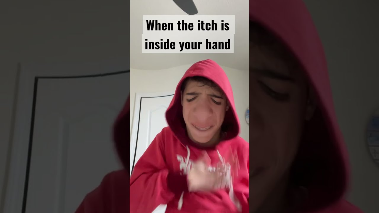 When The Itch Is Inside Your Hand Shorts Viral Foryou Subscribe
