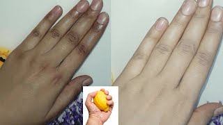 Best Hand & Feet Whitening Remedy For Get Fairness Very Fast | Hand & Feet Whitening Formula screenshot 4