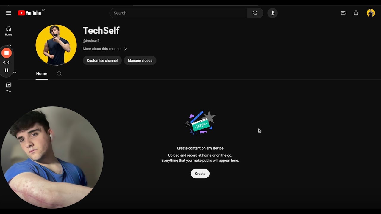 this tech nerd will quickly level up ur life by milking his broken arm