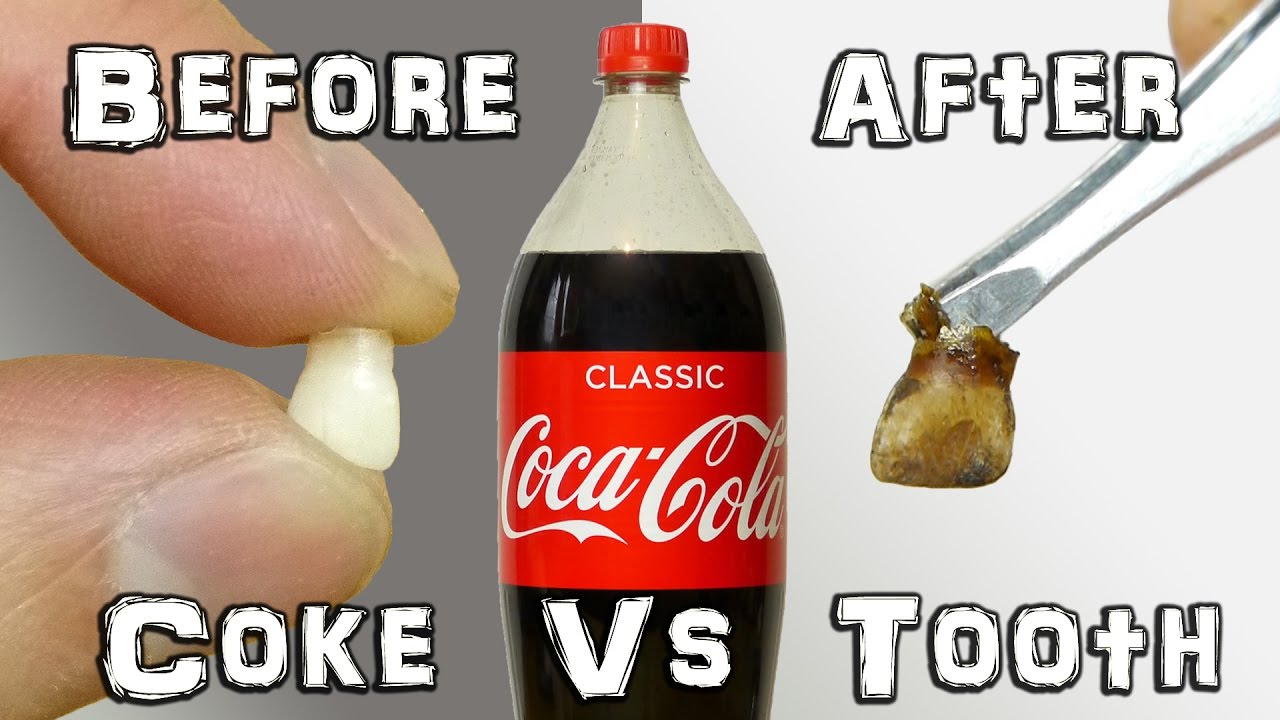 What Does It Do? - Coke Vs Teeth Experiment