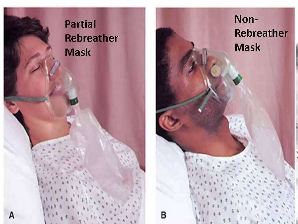 Difference Between Partial Rebreather Mask And Non Rebreather Mask