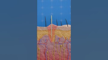 How To Remove Cactus Spines 🌵#fyp