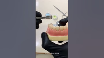 FORMA RÁPIDA E FÁCIL DE MONTAR O PORTA MATRIZ DE TOFFLEMIRE - ODONTO UFRGS