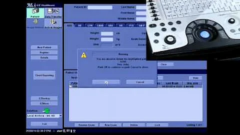 NextGen LOGIQ e: Deleting a Patient from the Hard Drive