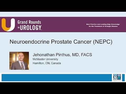 carcinoma de prostata neuroendocrinology carcinoma de prostata neuroendocrinology