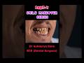 #dental #dentist #dentistry #shorts #youtube #smile #dentalclinic #orthodontist #trending #trend