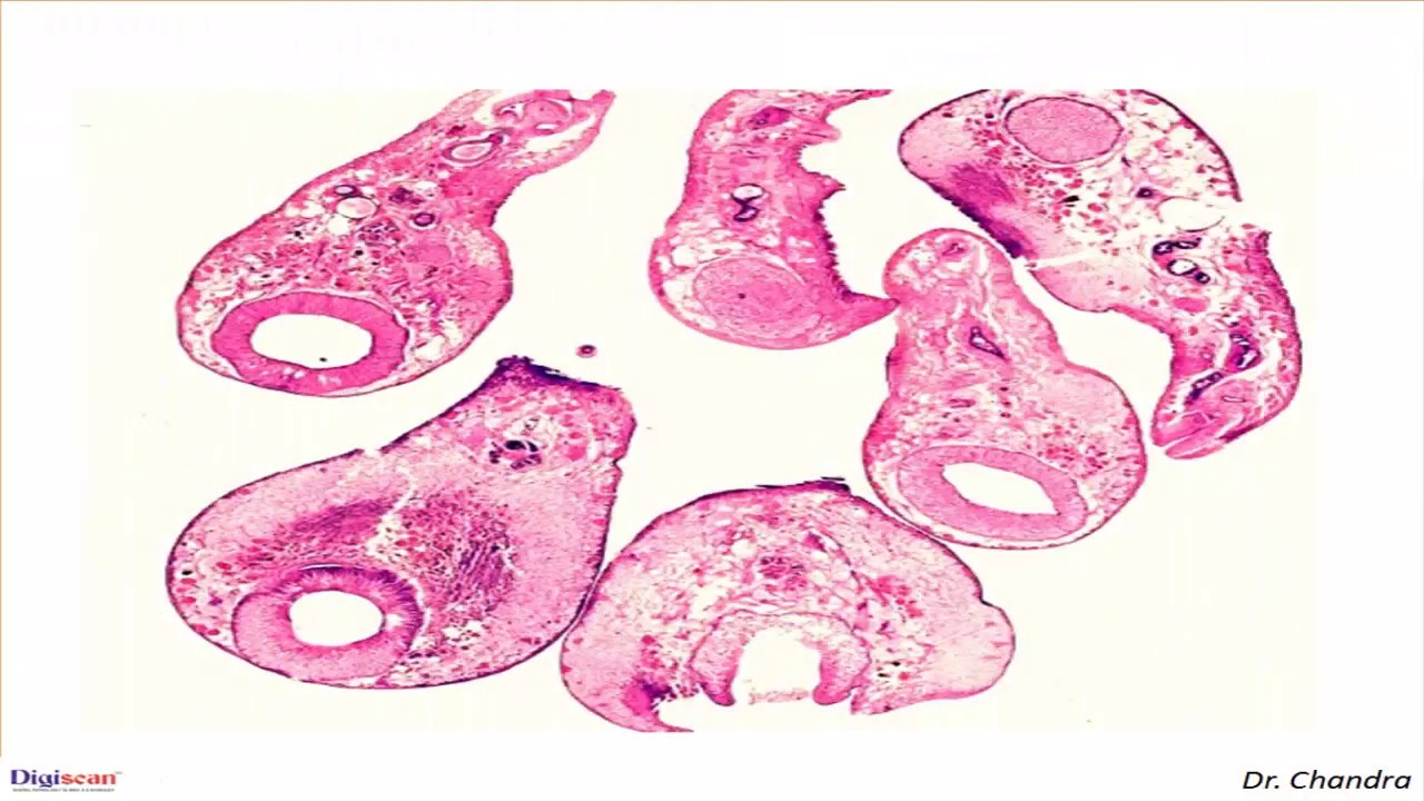 Parazita blastocystis, Bélparaziták ellen grapefruitmaggal