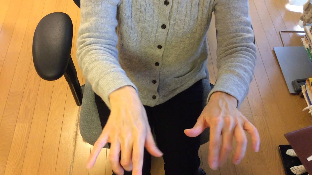 斜頸または頸部ジストニア：首の痛みを改善するにはどうすればよいですか？