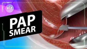 Deze 5 minuten durende test kan je leven redden (3D-animatie)